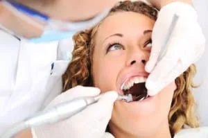Dental Fillings