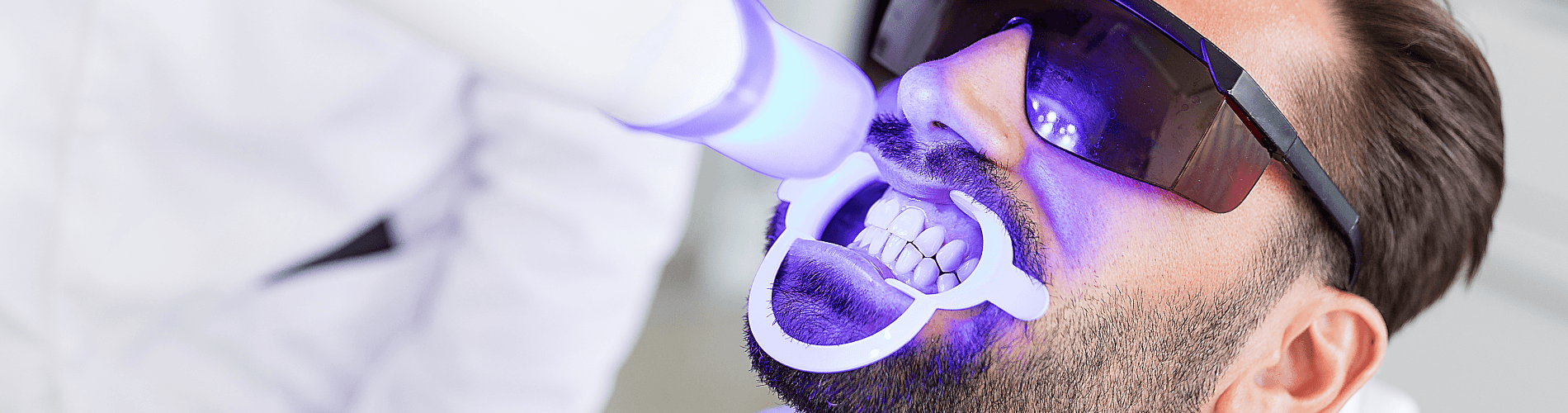 Cracked Tooth And How Is It Treated | Dental on Brisbane