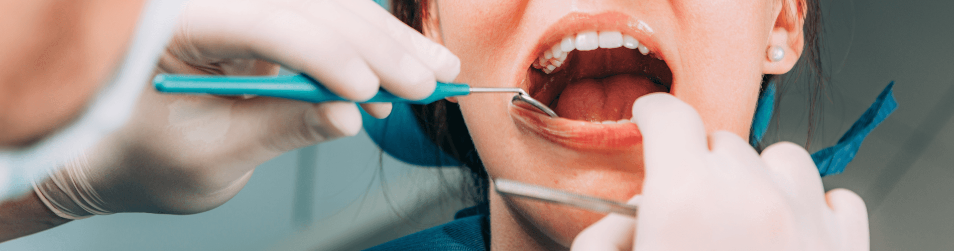 Dental For Kids | Dental On Brisbane