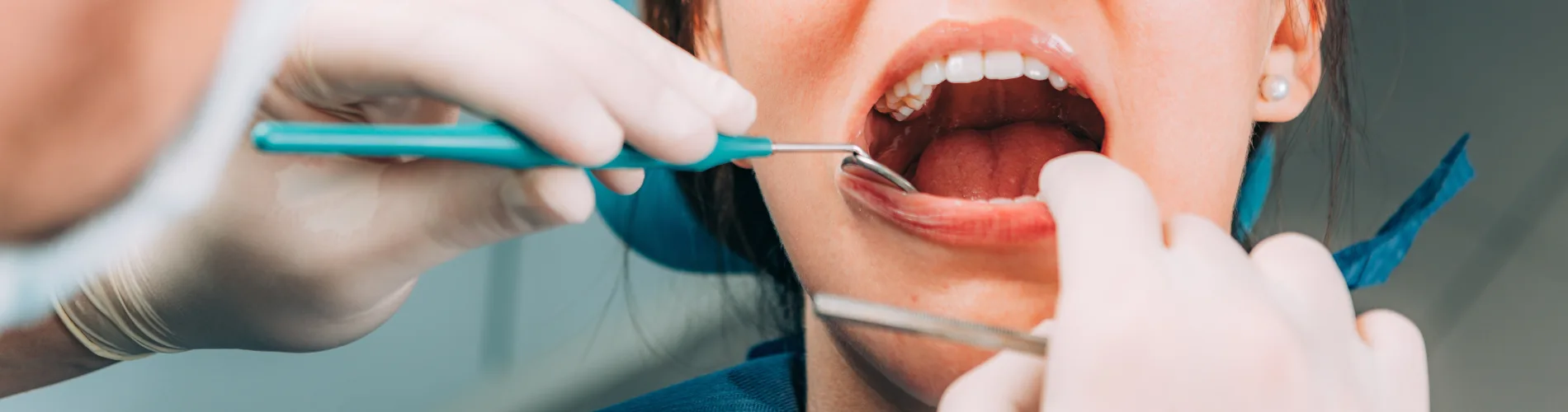 Dental For Kids | Dental On Brisbane