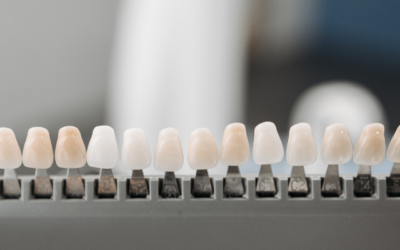 Dental Veneers brisbane