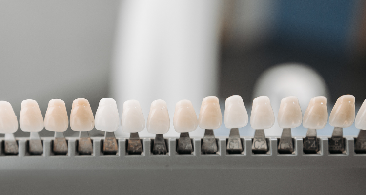Dental Veneers brisbane